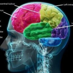 Dyslexia and the Brain